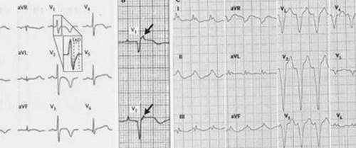 从吃瓜少女到娱乐姐妹：网络红人背后的神秘故事揭秘